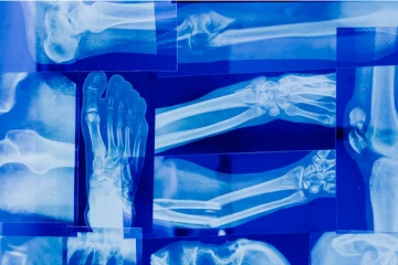 Image of X-rays
